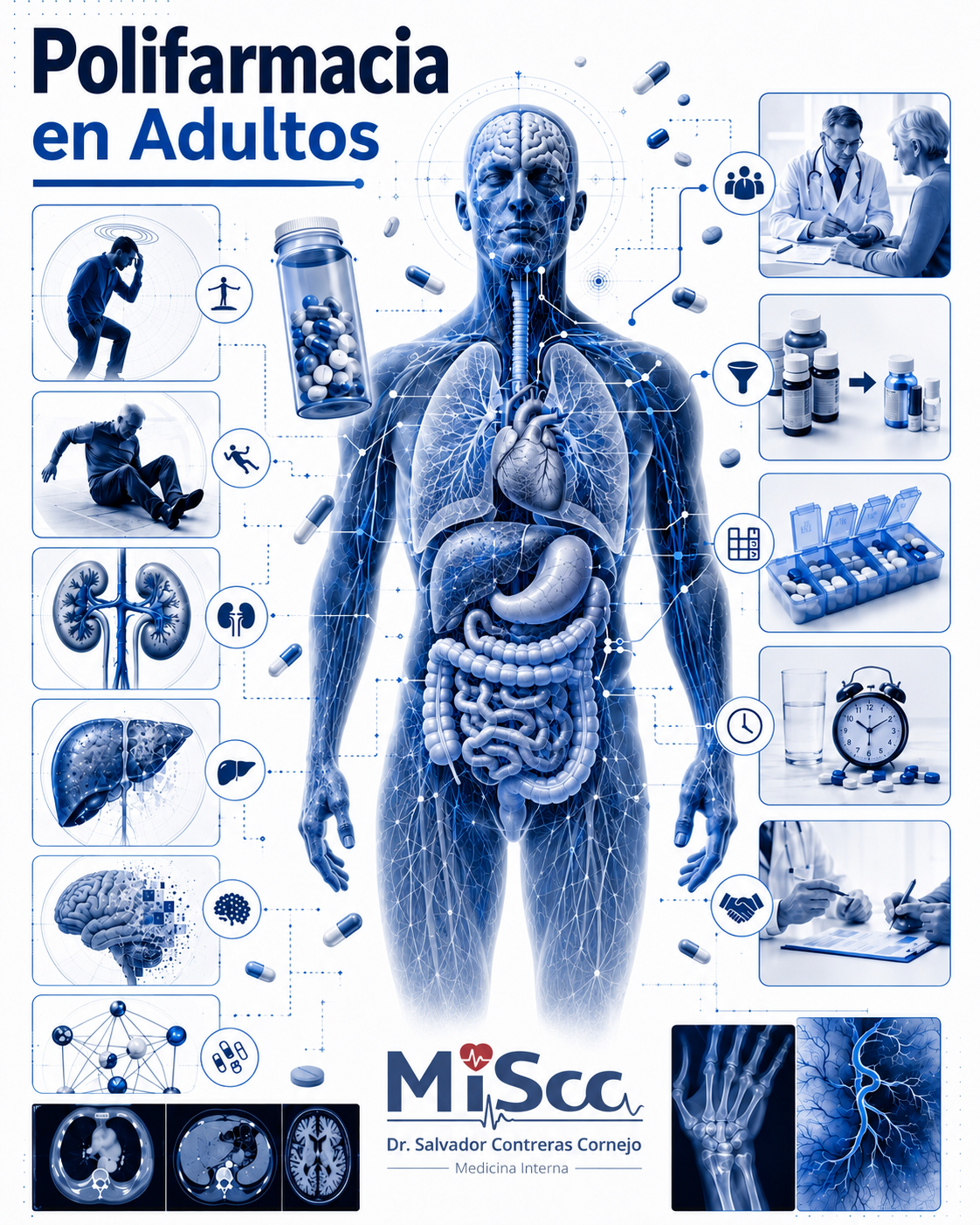 Polifarmacia en adultos: implicaciones y estrategias